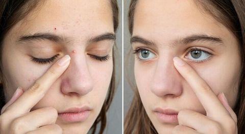 The Ultimate Guide to Fading Dark Spots: Insights from Skincare Experts