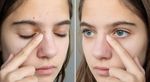 The Ultimate Guide to Fading Dark Spots: Insights from Skincare Experts